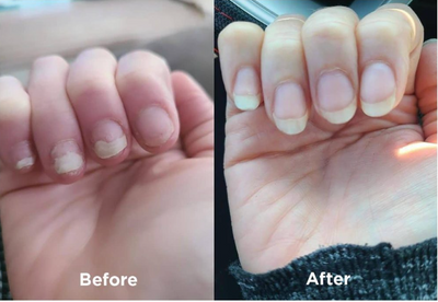 Lanvara™ Nail Rescue Pen